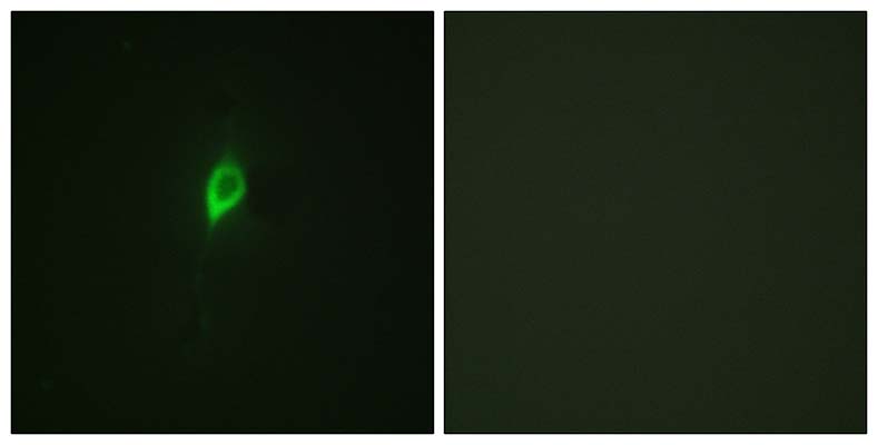 eIF4B (phospho Ser422) Rabbit Polyclonal Antibody | 兔多抗 | EnkiLife恩玑生命