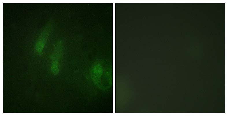 FANCA (phospho Ser1149) Rabbit Polyclonal Antibody | 兔多抗 | EnkiLife恩玑生命