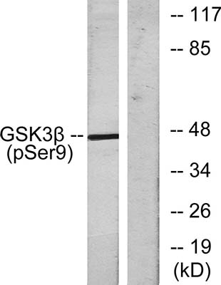 GSK3β (phospho Ser9) Rabbit Polyclonal Antibody | 兔多抗 | EnkiLife恩玑生命