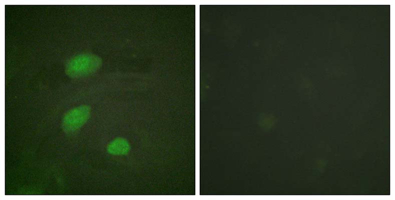 HIRA (phospho Thr555) Rabbit Polyclonal Antibody | 兔多抗 | EnkiLife恩玑生命