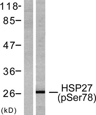 HSP27 (phospho Ser78) Rabbit Polyclonal Antibody | 兔多抗 | EnkiLife恩玑生命