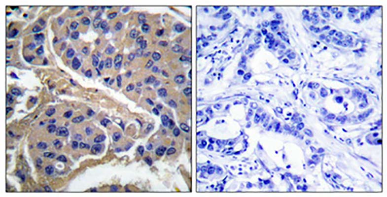 IRS-1 (phospho Ser307) Rabbit Polyclonal Antibody | 兔多抗 | EnkiLife恩玑生命