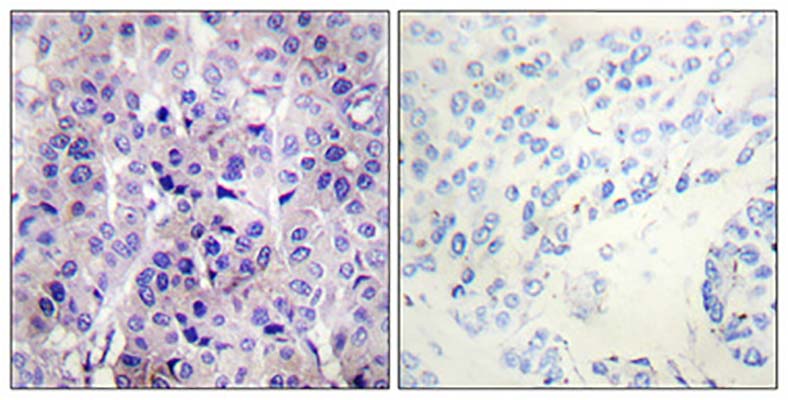 IRS-1 (phospho Ser307) Rabbit Polyclonal Antibody | 兔多抗 | EnkiLife恩玑生命