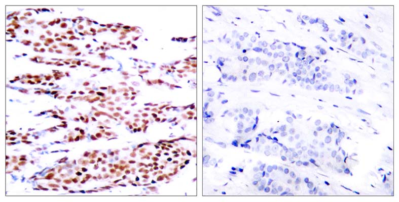 Jun B (phospho Ser79) Rabbit Polyclonal Antibody | 兔多抗 | EnkiLife恩玑生命