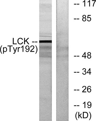 Lck (phospho Tyr192) Rabbit Polyclonal Antibody | 兔多抗 | EnkiLife恩玑生命