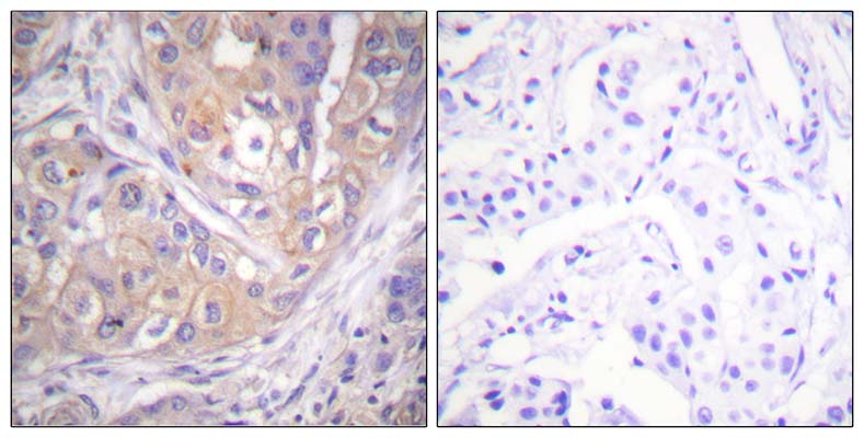 Lck (phospho Tyr505) Rabbit Polyclonal Antibody | 兔多抗 | EnkiLife恩玑生命