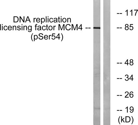 MCM4 (phospho Ser54) Rabbit Polyclonal Antibody | 兔多抗 | EnkiLife恩玑生命