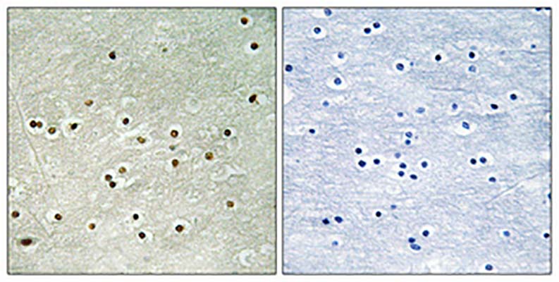 MCM4 (phospho Ser54) Rabbit Polyclonal Antibody | 兔多抗 | EnkiLife恩玑生命