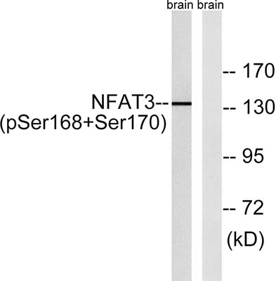 NFATc4 (phospho Ser168/S170) Rabbit Polyclonal Antibody | 兔多抗 | EnkiLife恩玑生命