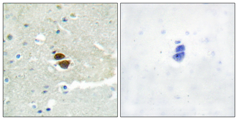NOS1 (phospho Ser852) Rabbit Polyclonal Antibody | 兔多抗 | EnkiLife恩玑生命