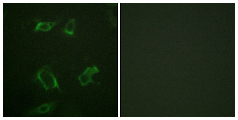 PC-PLD1 (phospho Ser561) Rabbit Polyclonal Antibody | 兔多抗 | EnkiLife恩玑生命