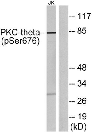 PKC θ (phospho Ser676) Rabbit Polyclonal Antibody | 兔多抗 | EnkiLife恩玑生命