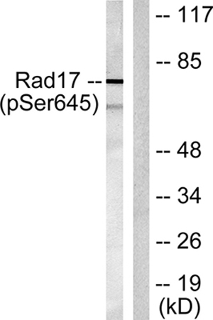Rad17 (phospho Ser645) Rabbit Polyclonal Antibody | 兔多抗 | EnkiLife恩玑生命