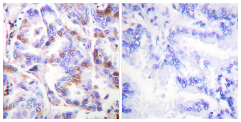 RPA32 (phospho Thr21) Rabbit Polyclonal Antibody | 兔多抗 | EnkiLife恩玑生命