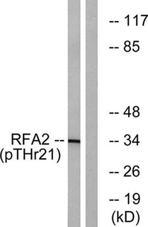 RPA32 (phospho Thr21) Rabbit Polyclonal Antibody | 兔多抗 | EnkiLife恩玑生命