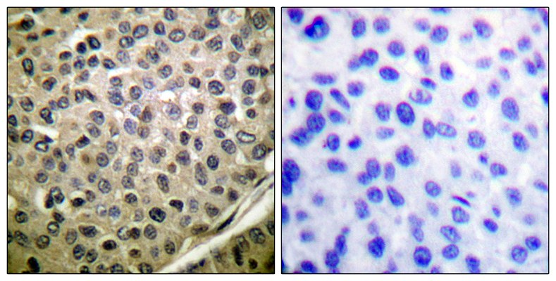 Stat4 (phospho Tyr693) Rabbit Polyclonal Antibody | 兔多抗 | EnkiLife恩玑生命