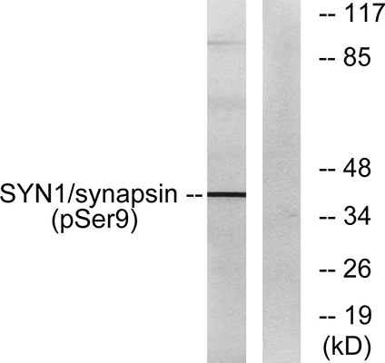 Synapsin I (phospho Ser9) Rabbit Polyclonal Antibody | 兔多抗 | EnkiLife恩玑生命