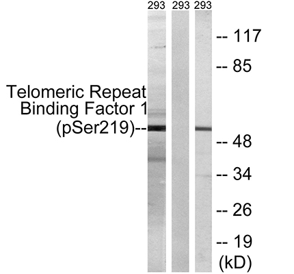 TRF1 (phospho Ser219) Rabbit Polyclonal Antibody | 兔多抗 | EnkiLife恩玑生命