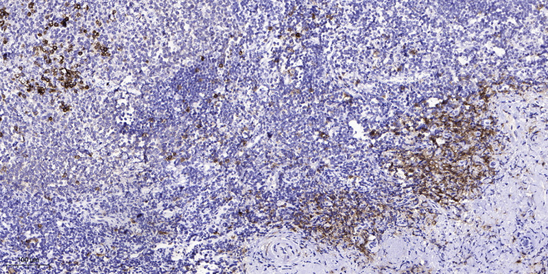 VHL (phospho Ser68) Rabbit Polyclonal Antibody | 兔多抗 | EnkiLife恩玑生命