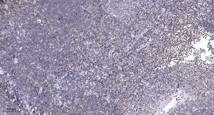 CFTR (Phospho-Ser737) Rabbit Polyclonal Antibody | 兔多抗 | EnkiLife恩玑生命
