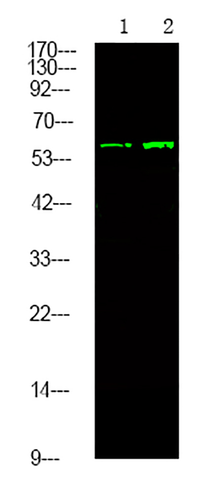 TGFBR2 (Phospho-Tyr284) Rabbit Polyclonal Antibody | 兔多抗 | EnkiLife恩玑生命