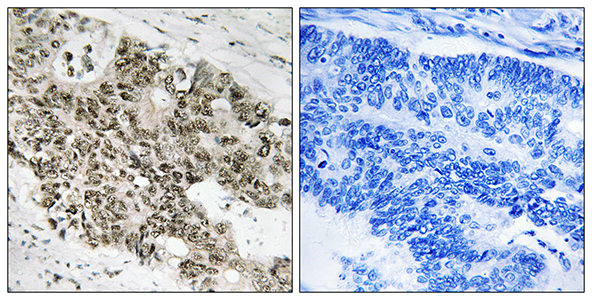 ATR Rabbit Polyclonal Antibody | 兔多抗 | EnkiLife恩玑生命