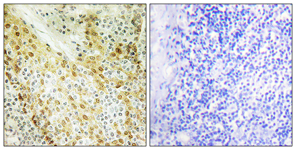 HIRA Rabbit Polyclonal Antibody | 兔多抗 | EnkiLife恩玑生命