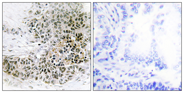 TRPS1 Rabbit Polyclonal Antibody | 兔多抗 | EnkiLife恩玑生命
