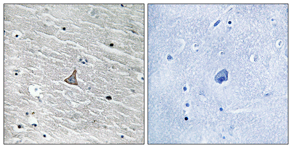 VHL Rabbit Polyclonal Antibody | 兔多抗 | EnkiLife恩玑生命