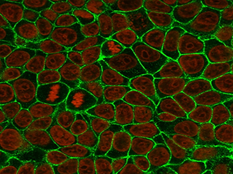 DiA（细胞膜绿色荧光探针）| 细胞膜荧光染料 | EnkiLife恩玑生命