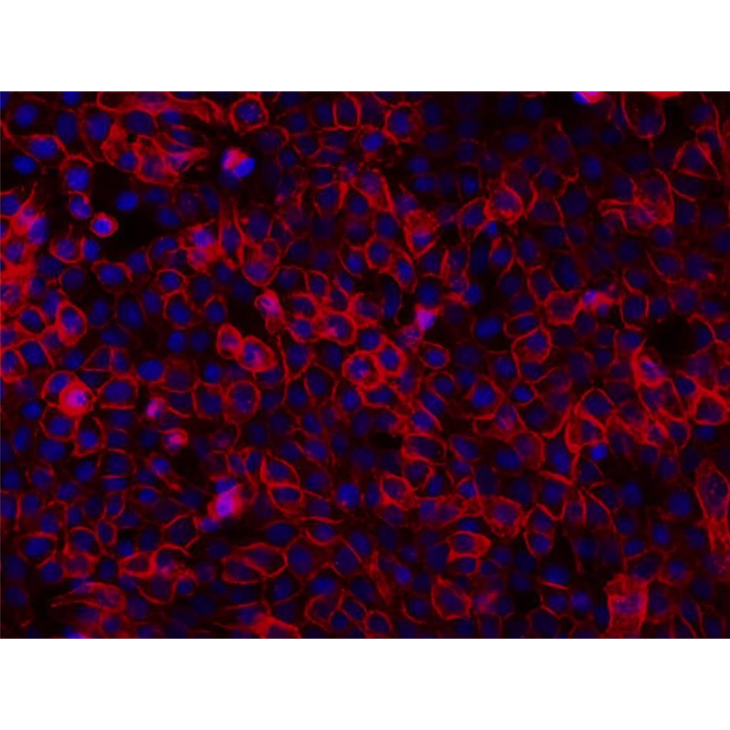 DiR（细胞膜近红外荧光探针）| 细胞膜荧光染料 | EnkiLife恩玑生命