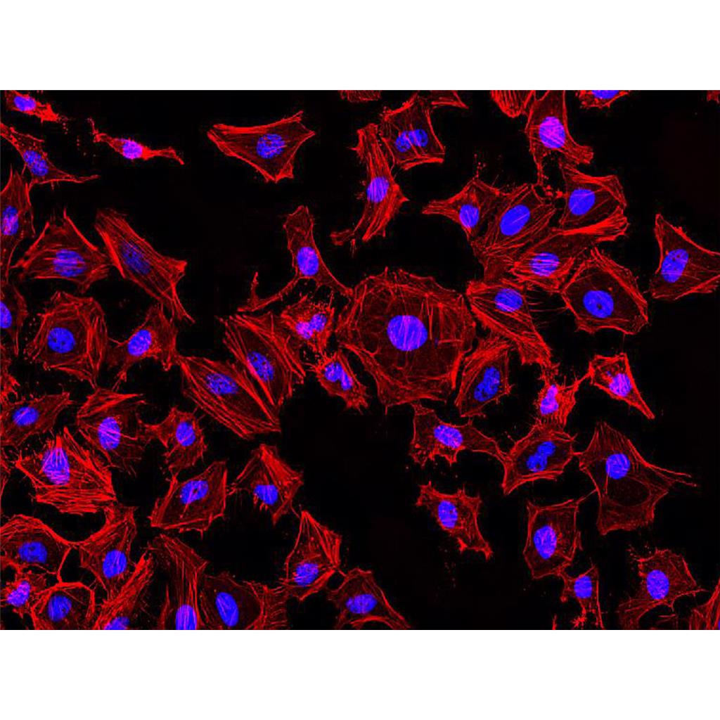 Rhodamine-Phalloidin（罗丹明标记鬼笔环肽）| 细胞骨架荧光染料 | EnkiLife恩玑生命