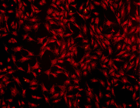 超氧化物阴离子荧光探针—DHE| 亚细胞结构荧光染料 | EnkiLife恩玑生命