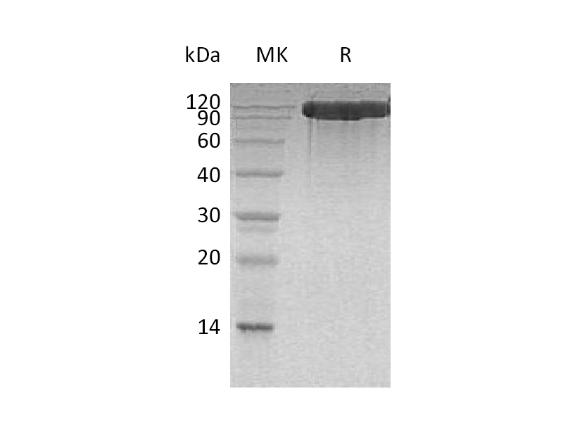 重组人ACE-2 (C-6His)蛋白 | EnkiLife恩玑生命