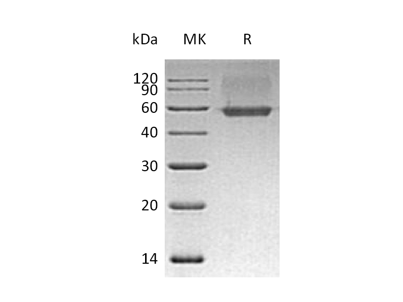 重组人AGER (C-6His)蛋白 | EnkiLife恩玑生命