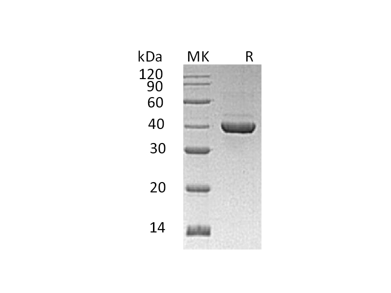 重组人ALDOC (C-6His)蛋白 | EnkiLife恩玑生命