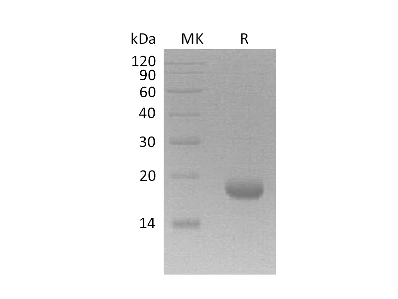 重组人IL-17F蛋白 | EnkiLife恩玑生命