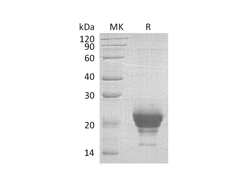 重组人RNASE 6 (C-6His)蛋白 | EnkiLife恩玑生命