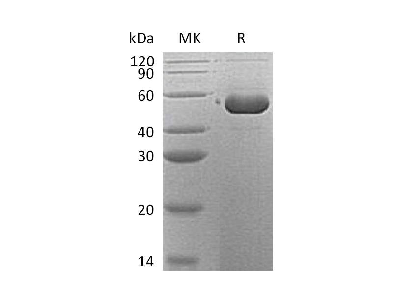 重组人Serpin B12 (C-6His)蛋白 | EnkiLife恩玑生命