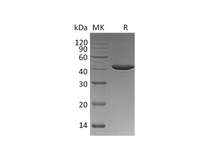 重组人Serpin B9 (C-6His)蛋白 | EnkiLife恩玑生命
