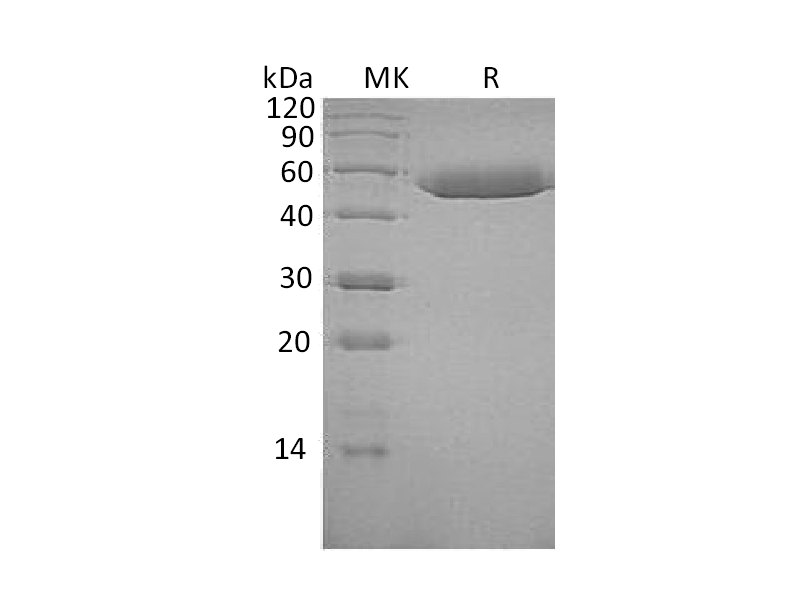 重组人Serpin F1 (C-6His)蛋白 | EnkiLife恩玑生命