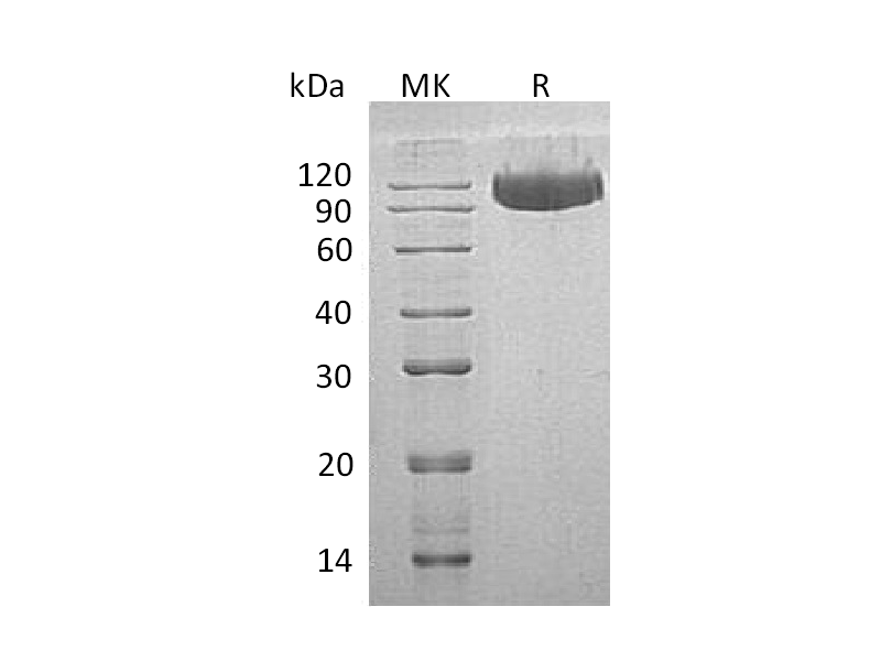 重组人Serpin G1 (C-6His)蛋白 | EnkiLife恩玑生命