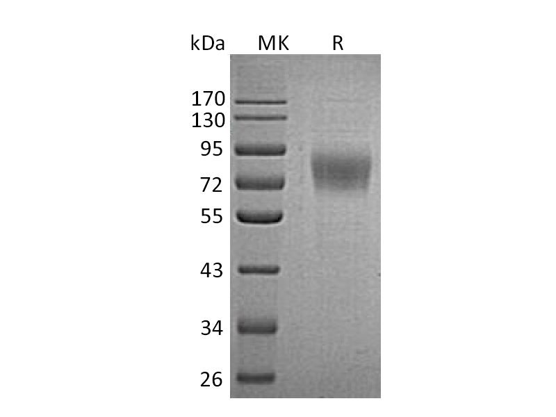 重组人PLXDC1 (C-6His)蛋白 | EnkiLife恩玑生命