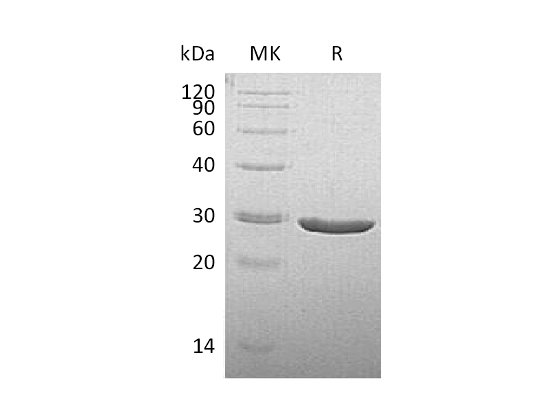 重组人TPK1 (C-6His)蛋白 | EnkiLife恩玑生命