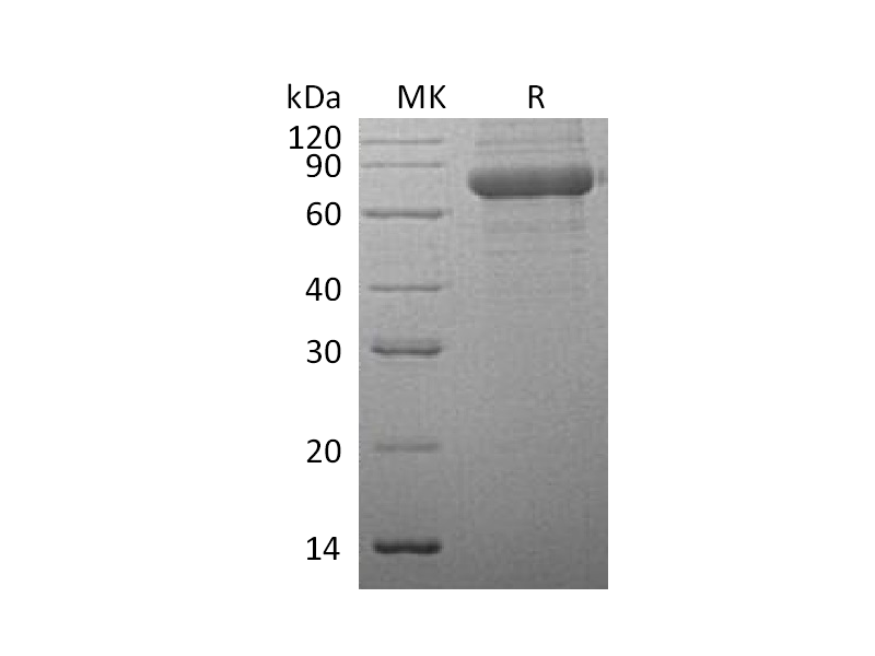 重组人TPP1 (C-6His)蛋白 | EnkiLife恩玑生命