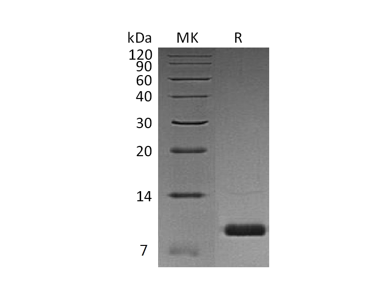 重组人Uteroglobin (C-6His)蛋白 | EnkiLife恩玑生命