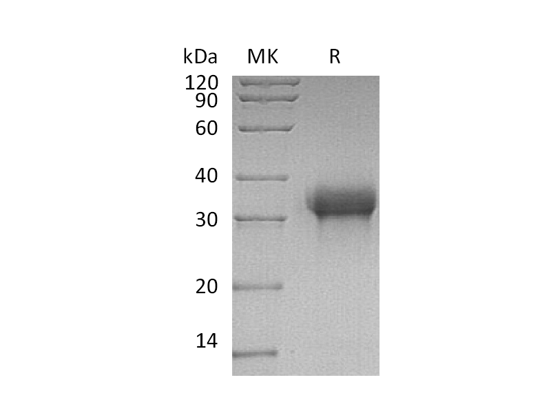 重组人Siglec-15 (C-6His)蛋白 | EnkiLife恩玑生命