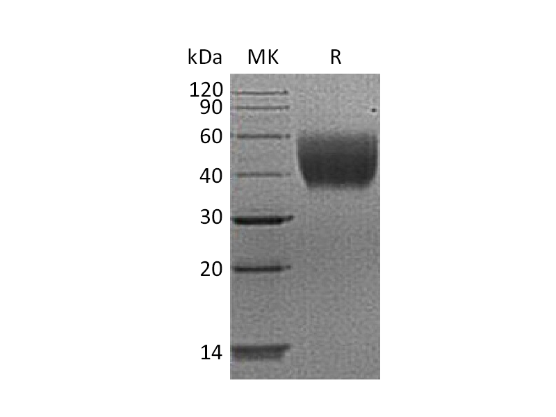 重组人IL-10RA (C-6His)蛋白 | EnkiLife恩玑生命