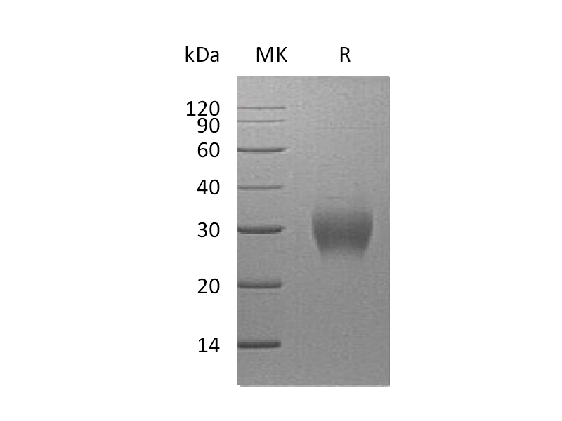 重组人Asprosin (N-8His)蛋白 | EnkiLife恩玑生命