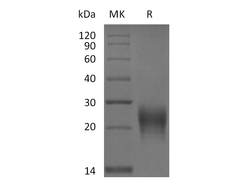 重组人Fas Ligand (N-6His)蛋白 | EnkiLife恩玑生命